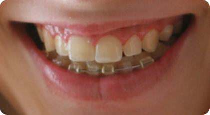 Parodontologie in der Zahnarztpraxis Dres von Landenberg