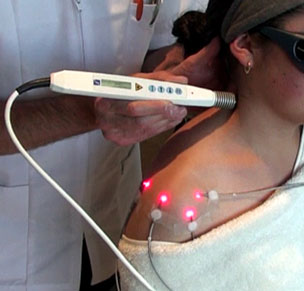 Lightneedle Laser Therapy