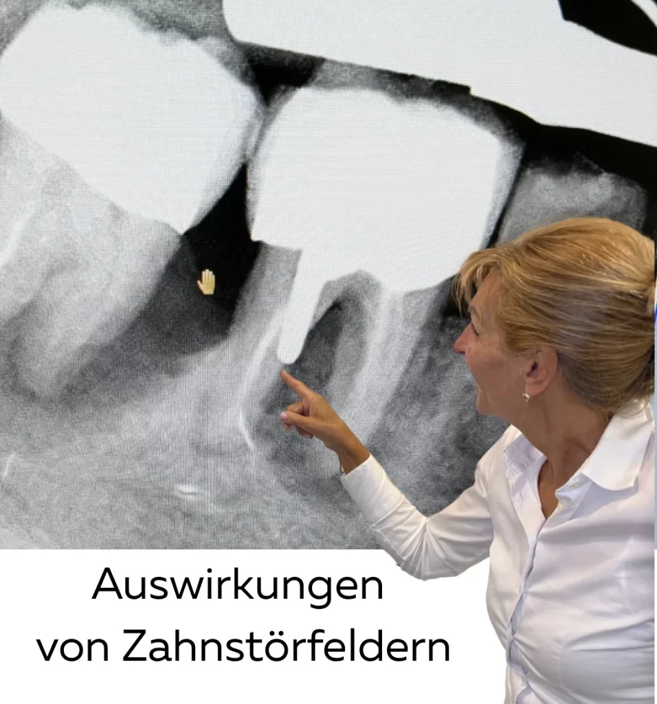 Auswirkungen von Zahnstoerfeldern